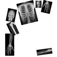 Le corps humain aux rayons X - Roylco thumbnail image
