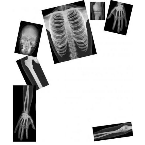 Le corps humain aux rayons X thumbnail image 1